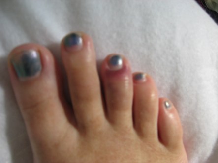 Hurt Toe 4-6-12