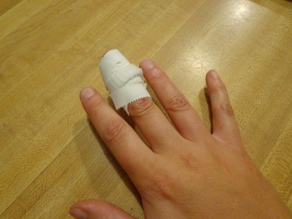 Wood Splitting Accident 8-8-19